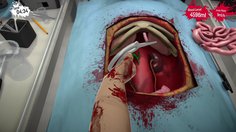 Surgeon Simulator: Anniversary Edition_Kidney - Part 2